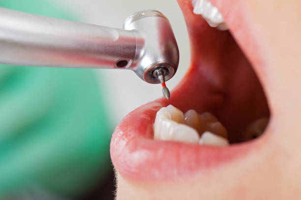Best Weekend Emergency Dentist in Citrus, CA